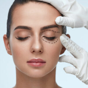 BLEFAROPLASTIA SIN CIRUGÍA